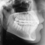 Radiologia Odontológica em Ananindeua